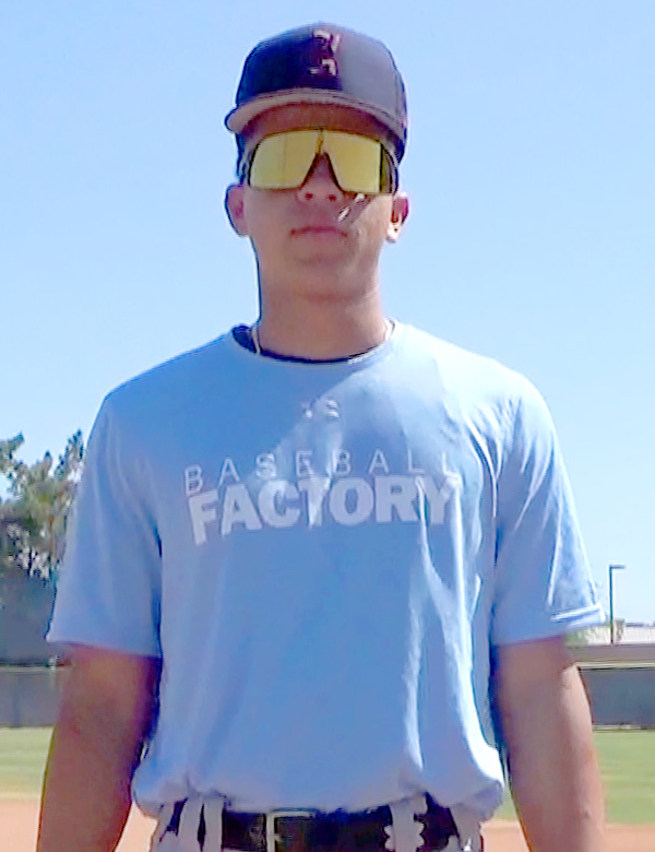 Jose Fernandez